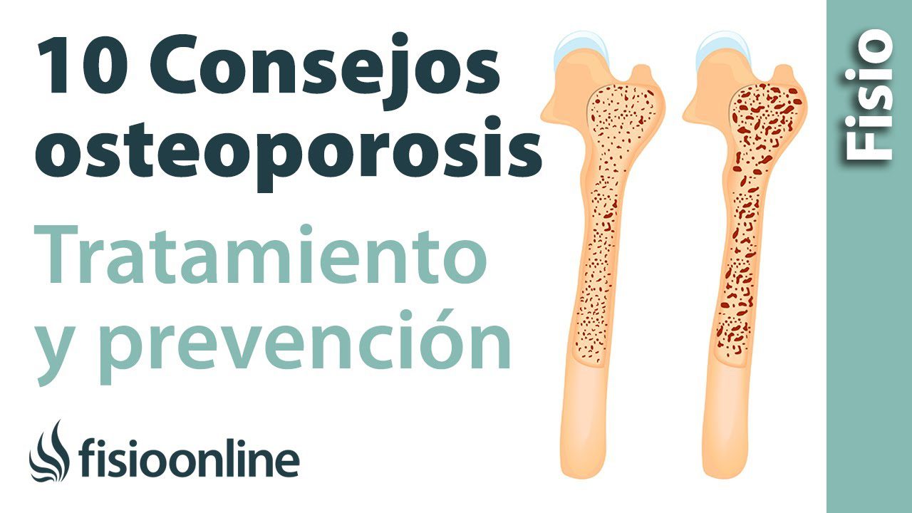 Como-mejorar-la-salud-osea-consejos-para-prevenir-la-osteoporosis-en-hombres - Hunter Magazine